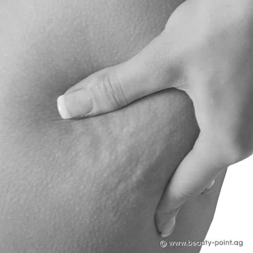 Problemzonen-Behandlung Problemzonen-Behandlung Beauty-Studio Anita in Hof bei Salzburg